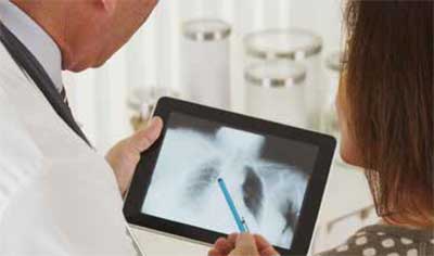 top-8-faq-how-ongo-cbrs-are-shaping-healthcare-connectivity